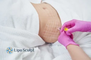 Are The Results From Aqualyx Permanent? 1 Do you want to know how long Aqualyx Arnold results last?
