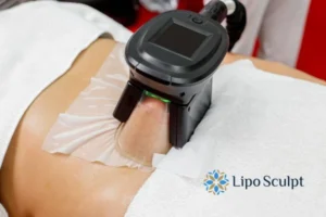 Does Fat Freezing At Home Work? 3 Fat freezing at home from Lipo Sculpt Arnold